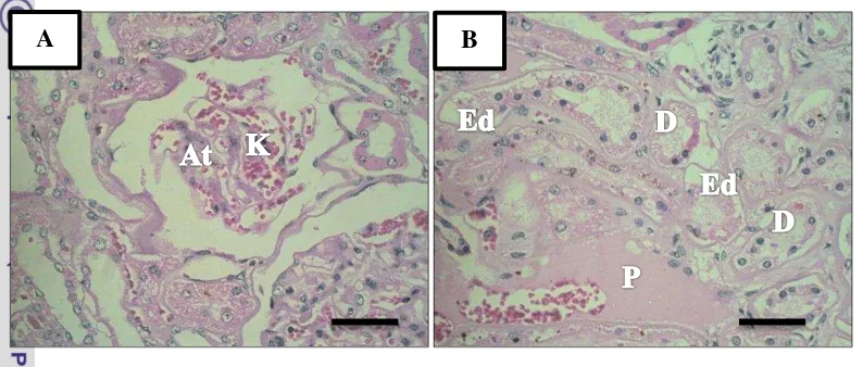 Gambar 6  Gambar histopatologi ginjal.  (A) Terdapat glomerulus yang mengalami atrofi (At) 