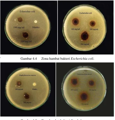 Gambar 4.5 Zona hambat bakteri Staphylococcus aureus. 