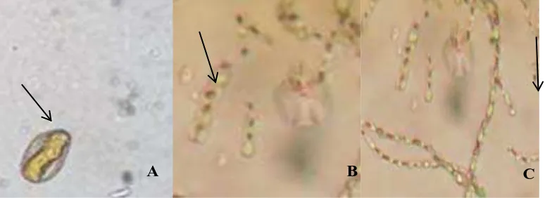 Gambar 3. Tampilan Mikroskopis Fungi P. psidii A. Urediniospora B. Teliospora  C. Basidiospora  