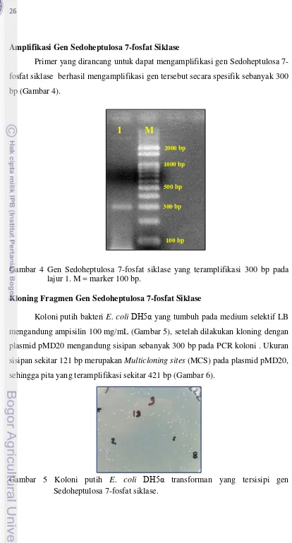 Gambar 4 Gen Sedoheptulosa 7-fosfat siklase yang teramplifikasi 300 bp pada 