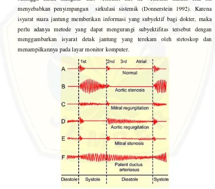 Gambar 2.2 Ragam gelombang suara jantung normal dan abnormal (Suardi et al: 2007) 