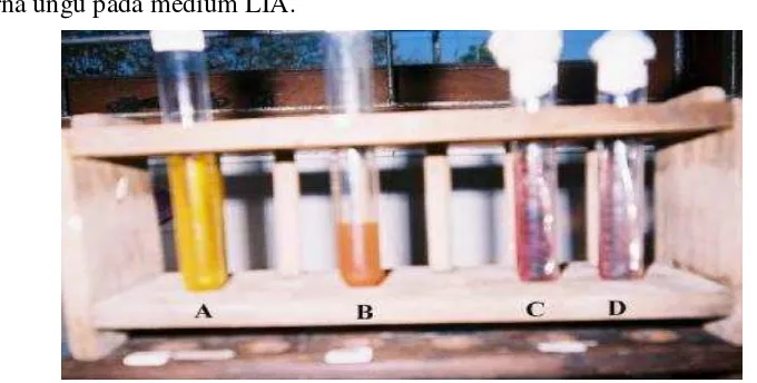Gambar 2. Media cair LB, SCB, TSIA dan LIA yang telah diinokulasi dengan bakteri Salmonella ATCC 10708 yang digunakan sebagai kontrol positif Keterangan: A