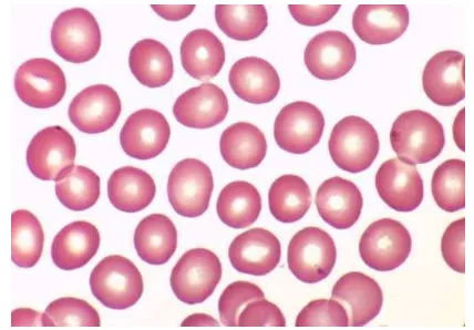 Gambar 4 Sel darah merah normal dilihat secara mikroskopis (Vidinsky 2011). 
