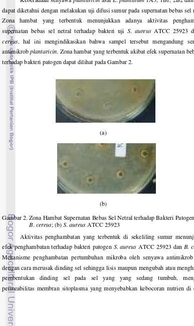 Gambar 2. Zona Hambat Supernatan Bebas Sel Netral terhadap Bakteri Patogen  (a)   