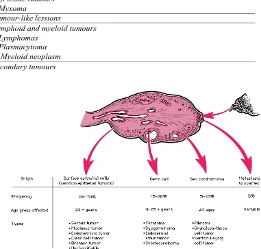 Gambar 2.2. Pembagian Tumor Ovarium Menurut Sel Asalnya3 