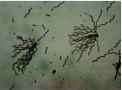 Gambar 2. Salmonella typhi.      Sumber: Black (2005)