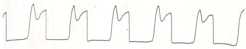 Gambar 22. Output Blok Rangkaian Vertikal Oscilator Pada Saat Saklar diputuskan ( 2,8 Vpp ) 