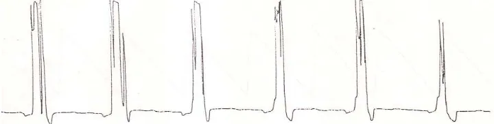 Gambar 17. Output Blok Rangkaian Penguat Krominan ( 0,4 Vpp ) 