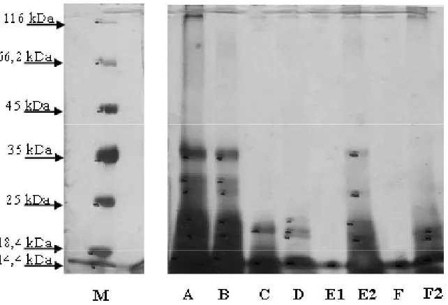Gambar 5 Pola perubahan nilai rejeksi aktivitas enzim protease pada permeat yang disebabkan oleh perubahan TMP dan suhu pada membran UF poliakrilonitril MWCO 100 kDa (a) dan polisulfon MWCO 50 kDa (b).