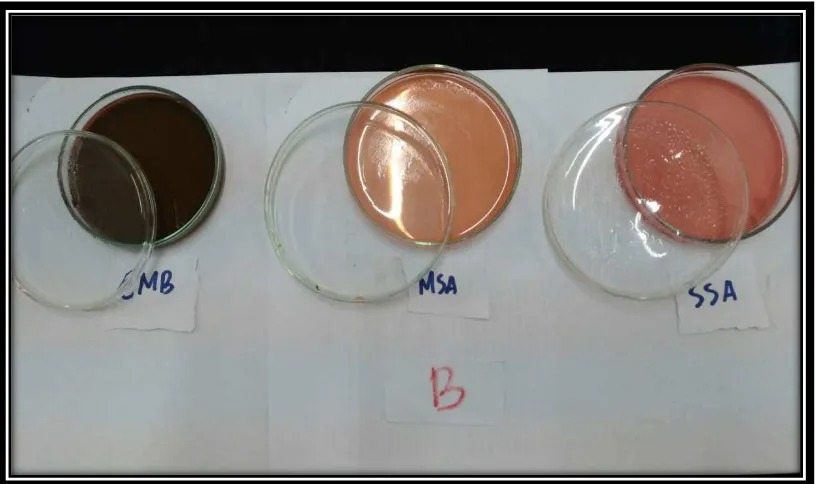 Gambar lampiran 5. Hasil Pemeriksaan Bakteri Escherichia coli, Staphylococcus  dan pada daging sapi beku Transmart Medan fair 
