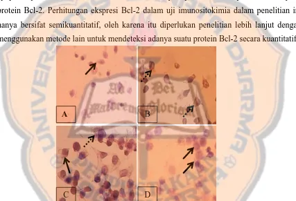Gambar 4. Efek ekstrak metanol daun rosemary dan cisplatin dalam menekan ekspresi Bcl-2 pada sel kanker selama 24 jam