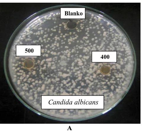 Gambar Hasil Uji Aktivitas Antimikroba Ekstrak Metanol Buah Belimbing Manis Terhadap Jamur Candida albicans 