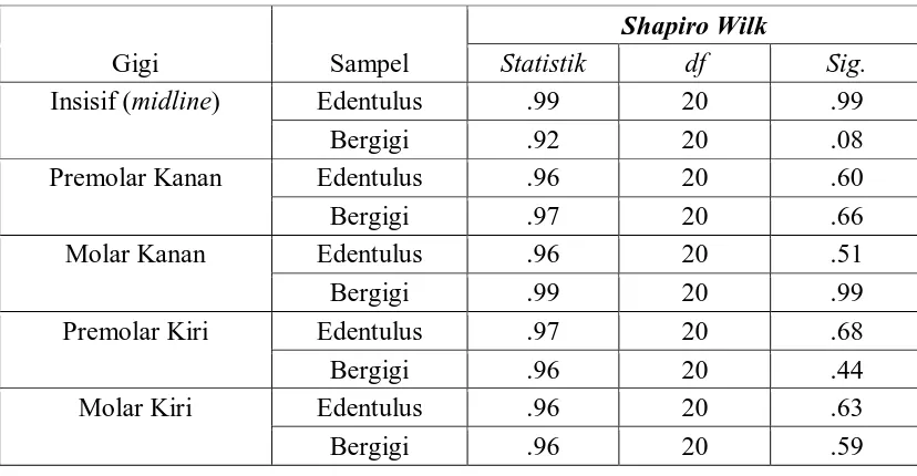 Tabel 2.  Hasil  pengukuran  nilai  rata-rata  ketinggian  maxillary  alveolar  ridge  pada                 wanita edentulus dan wanita bergigi 