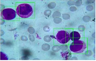 Gambar 5 Output sistem deteksi sel darah putih 