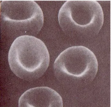 Gambar 5. Fotomikograf elektron eritrosit normal. Perbesaran 3300 x (Junquiera dkk., 1997)