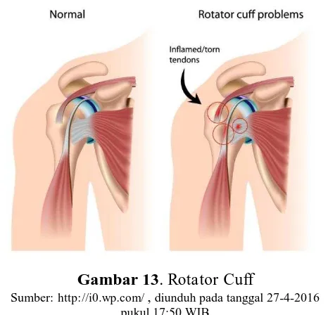 Gambar 13. http://i0.wp.com/ Rotator Cuff , diunduh pada tanggal 27-4-2016 