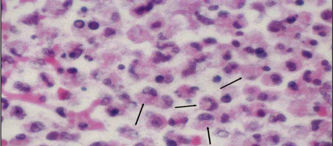 Gambar 4. Sel Makrofag (panah hitam), memiliki bentuk seperti ginjal,             sering berada di satu sisi dari sel.28 
