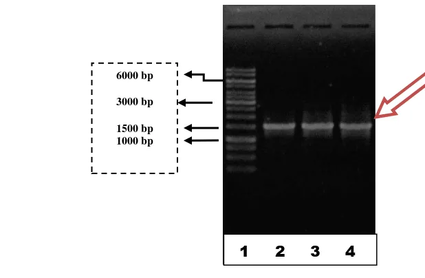 Gambar 10.  Elektroforegram amplikon hasil identifikasi 16S rRNA 
