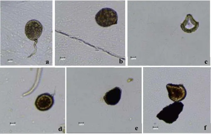 Gambar 1. Spora Mikoriza hasil dari ekstraksi spora dari lokasi pertanaman tebu yaitu: (a) Glomus spp.; (b) Gigasporaspp.; (c) Acaulospora spp.; (d) Scutellospora spp.; (e) Entrophospora spp.; (f) Sclerocystis spp.