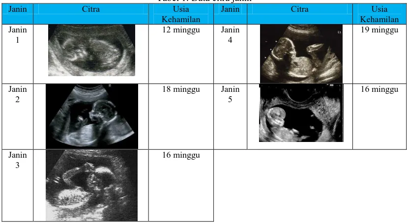 Tabel 1. Data citra janin Usia Kehamilan 