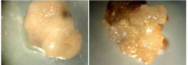 Gambar 3. Kalus yang tidak berpeluang embriogenik (kiri) dan yang berpeluang embriogenik pada 8 minggu setelah perlakuan (kanan) dengan mikroskop perbesaran 20x