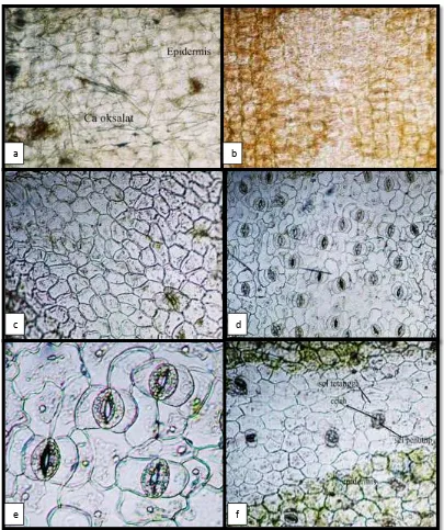 Gambar 1.hasil sayatan anatomi pada bagian tumbuhan (a) Epidermis pada batang semu (petiolus) memperlihatkan kristal oksalat, (b) sayatan epidermis pada buah memperlihatkan bentuk sel epidermis, (c) epidermis daun bagian atas, (d)  epidermis daun bagian ba