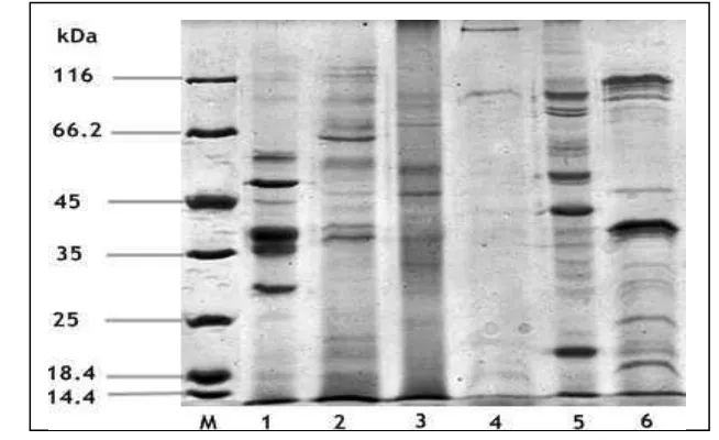 Gambar 5.  Pola elektroforesis fraksi protein. M: low-molecular-