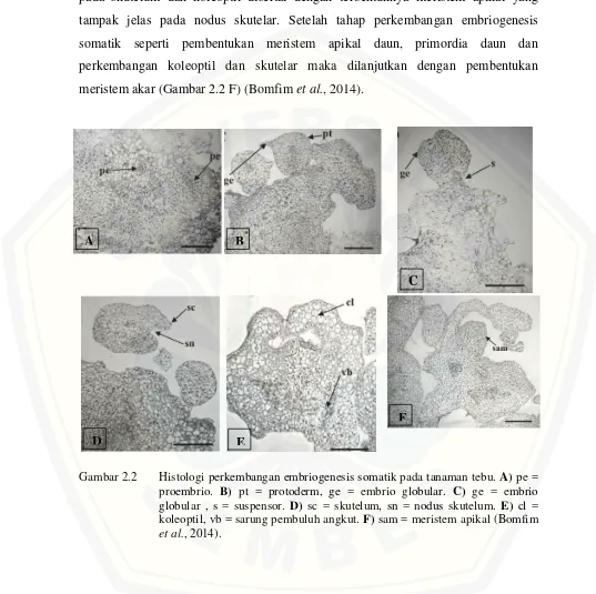 Gambar 2.2 Histologi perkembangan embriogenesis somatik pada tanaman tebu. A) pe = 