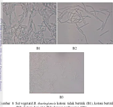 Gambar  8  Sel vegetatif B. thuringiensis koloni  tidak bertitik (B1), koloni bertitik    