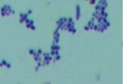 Gambar 4.1 Sediaan S. mutans terlihat berwarna ungu pada pemeriksaan mikroskopik sesuai       dengan sifat Streptococcus, yaitu gram positif  berbentuk kokus berpasangan        atau berantai (Pengecatan Gram, pembesaran 1000x)