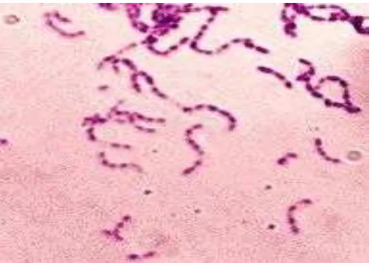 Gambar 2.4 Streptococcus mutans dengan pewarnaan Gram  (Todar, 2006) 