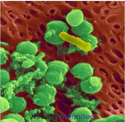 Gambar 2.7 Gambaran mikroskopis koloni S. mutans pada epitel lidah (Kunkel, 2010) 