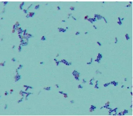 Gambar 4.2 Sediaan S. mutans terlihat berwarna biru tua pada pemeriksaan mikroskopik    sesuai  dengan sifat S