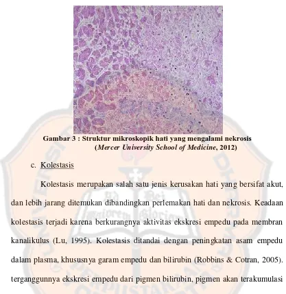Gambar 3 : Struktur mikroskopik hati yang mengalami nekrosis(, 2012)
