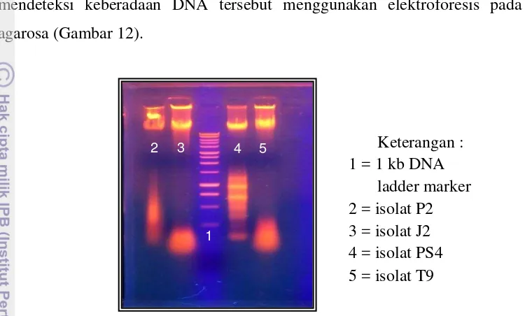 Gambar 13. Hasil amplifikasi gen 16S rRNA 