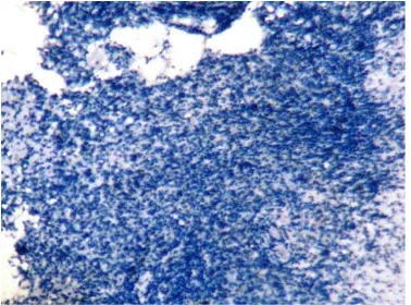 Gambar 9. Pewarnaan immunohistokimia TNF- positif <10%) yang terekspresi dengan warna coklat (tanda panah) pada αskor +1 (pewarnaan jaringan KNF dengan pembesaran x100 