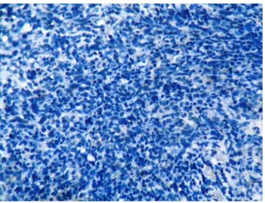 Gambar 12. Pewarnaan immunohistokimia TNF-αskor 0 (negatif)pada jaringan KNF dengan pembesaran x400 