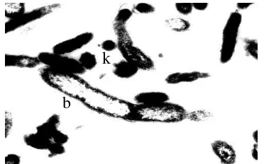 Gambar 2 Coxiella burnetii dengan mikrograf elektron pada pembesaran             