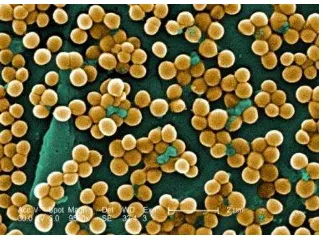 Gambar 4. Morfologi Staphylococcus aureus Sumber: Milton (2010) 
