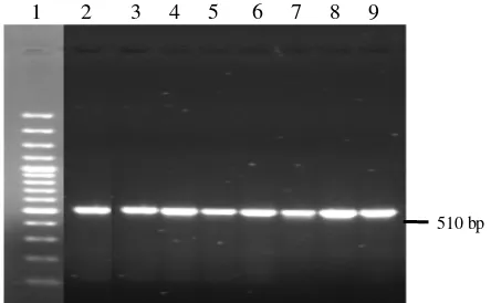 Gambar 7 Hasil amplifikasi daerah D-Loop pada gel agarosa 1.2%. Keterangan : kolom 1 = marker 100 bp, kolom 2-3= kelinci rex (RR1 dan RR3), kolom 4-5 = kelinci satin (SS2 dan SS3), kolom 6 = kelinci reza (RS3), kolom 7-9 = kelinci medium reza (FZRS1, FZRS2