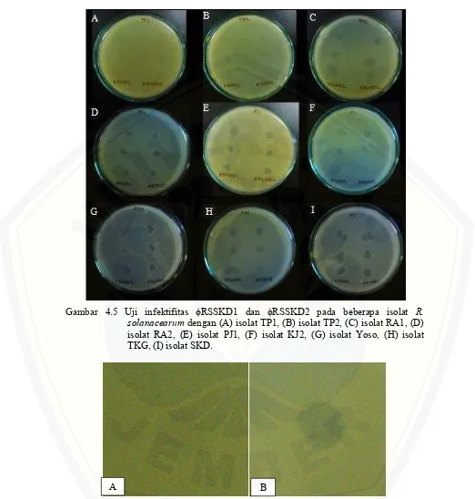 Gambar 4.6 Kenampakan jenis plaque yang berbeda dilihat dari tingkat kekeruhan (A) jenis plaque keruh, (B) jenis plaque bening