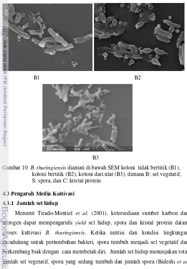 Gambar 10  B. thuringiensis diamati di bawah SEM koloni  tidak bertitik (B1),      