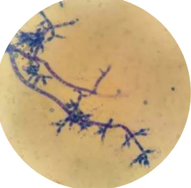 Gambar 3. Mikroskopis Trichoderma spp. 