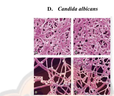 Gambar 4. Mikrograf fluoresensi Candida albicans dewasa. A) sebelum diinkubasi dengan thymolmulti-layer