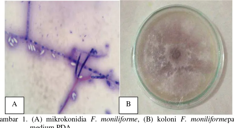 Gambar 1. (A) mikrokonidia  F. moniliforme, (B) koloni F. moniliformepada 