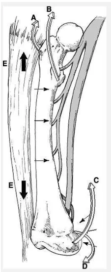 Gambar 3 :Deforming muscle pada femur; abductors (A), iliopsoas (B), adductors (C), and origo gastrocnemius (D)