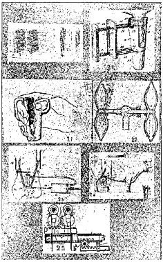 Gambar 2.5 Pressure devices pada puting sapi (Erf, 1906) 