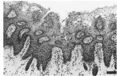 Gambar 4.  Histopatologi pada epidermis badak (badak afrika) yang menunjukkan adanya degenerasi hidroskopik, dan pembentukan celah/retakan pada kulit
