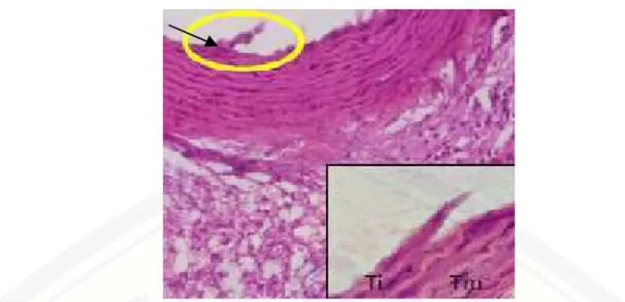 Gambar 2.5 Kerusakan  endotel  akibat  LDL-oks tampak  tidak  rata pada  tunika  intima, ditunjukkan  dengan  tanda  panah,  perbesaran  1000x (Sumber:  Fanny et  al., 2012)