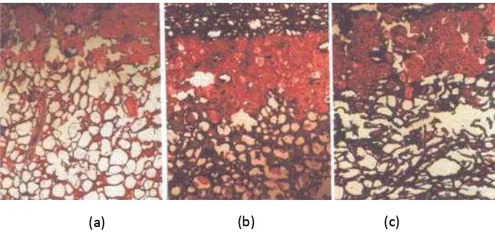 Gambar 3  Penampang melintang kulit buah manggis (a) pada awal dan         (b & c) pada akhir penyimpanan (Qanytah 2004)
